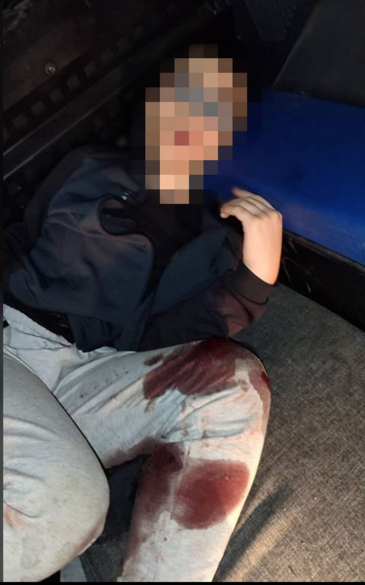 O suspeito ficou ferido no ataque - Reprodu&ccedil;&atilde;o / Redes Sociais