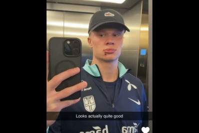 Haaland sofre acidente com ônibus da Noruega e leva pontos na boca