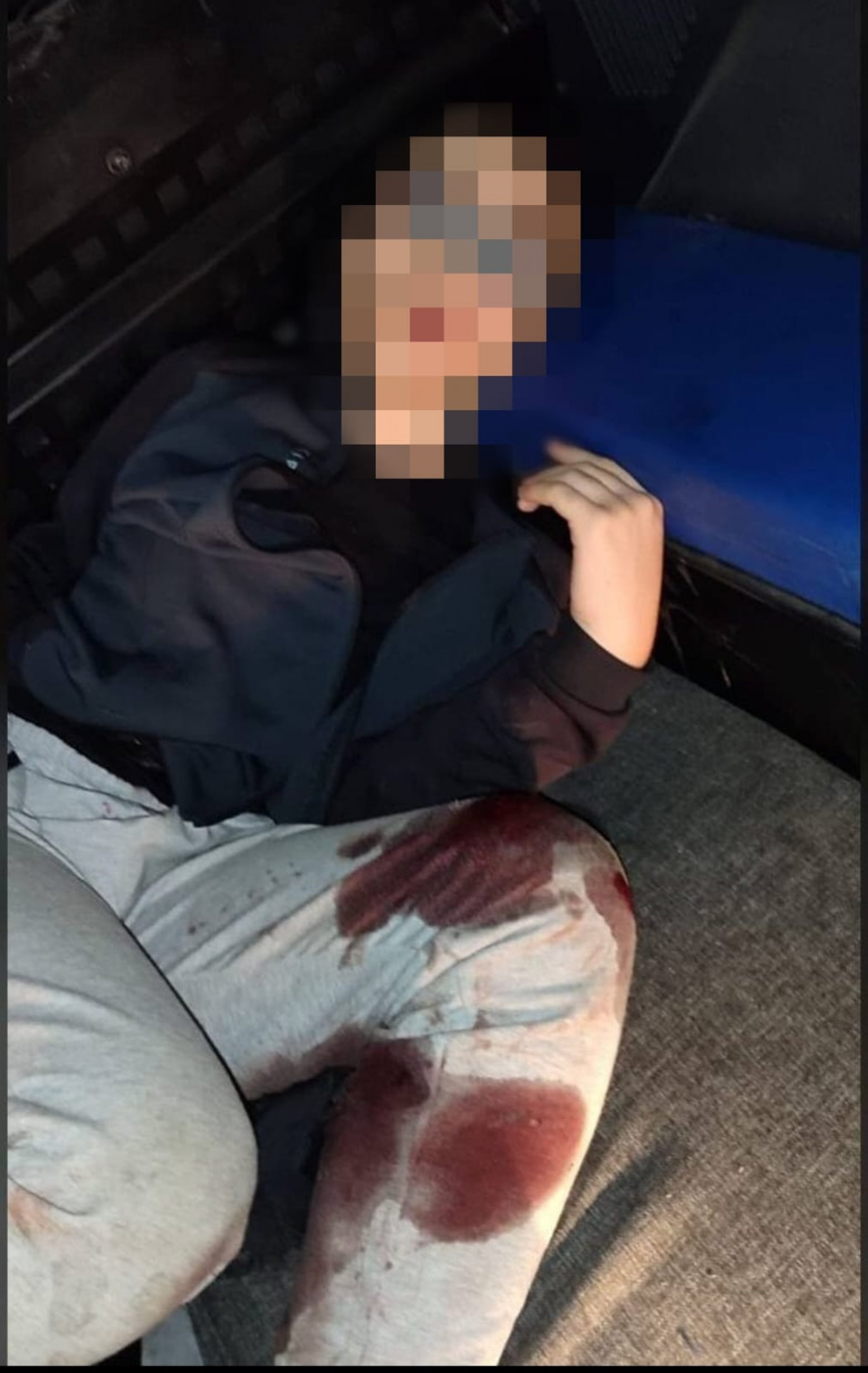 O suspeito ficou ferido no ataque