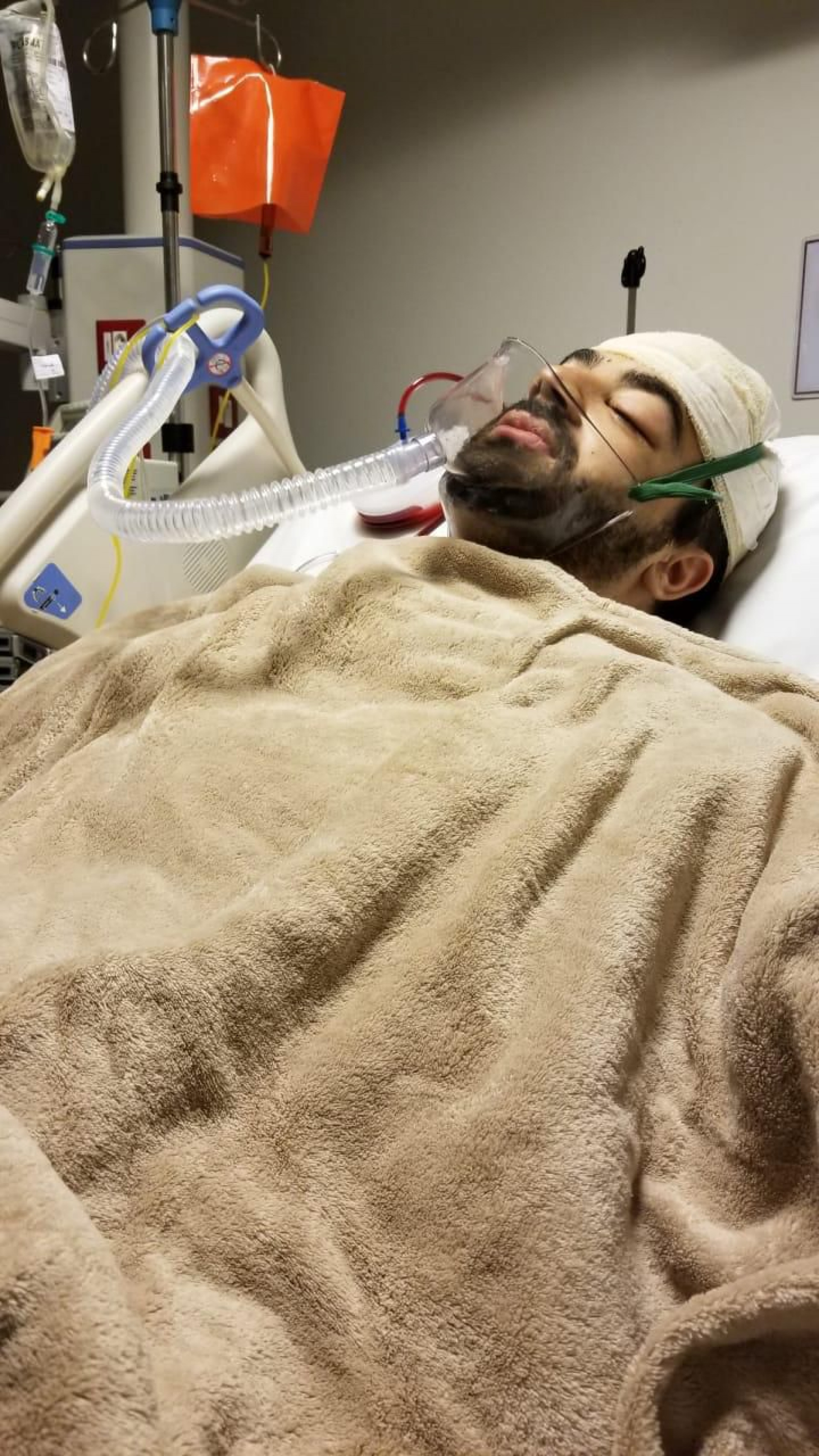 Com a autoriza&ccedil;&atilde;o da fam&iacute;lia, Bruno passou a integrar o estudo acad&ecirc;mico da UFRJ ap&oacute;s o acidente que sofreu - Divulga&ccedil;&atilde;o / Faperj