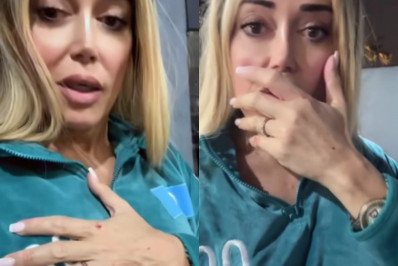 Vídeo: Mulher Abacaxi se machuca em tentativa de assalto: 'Que desespero'