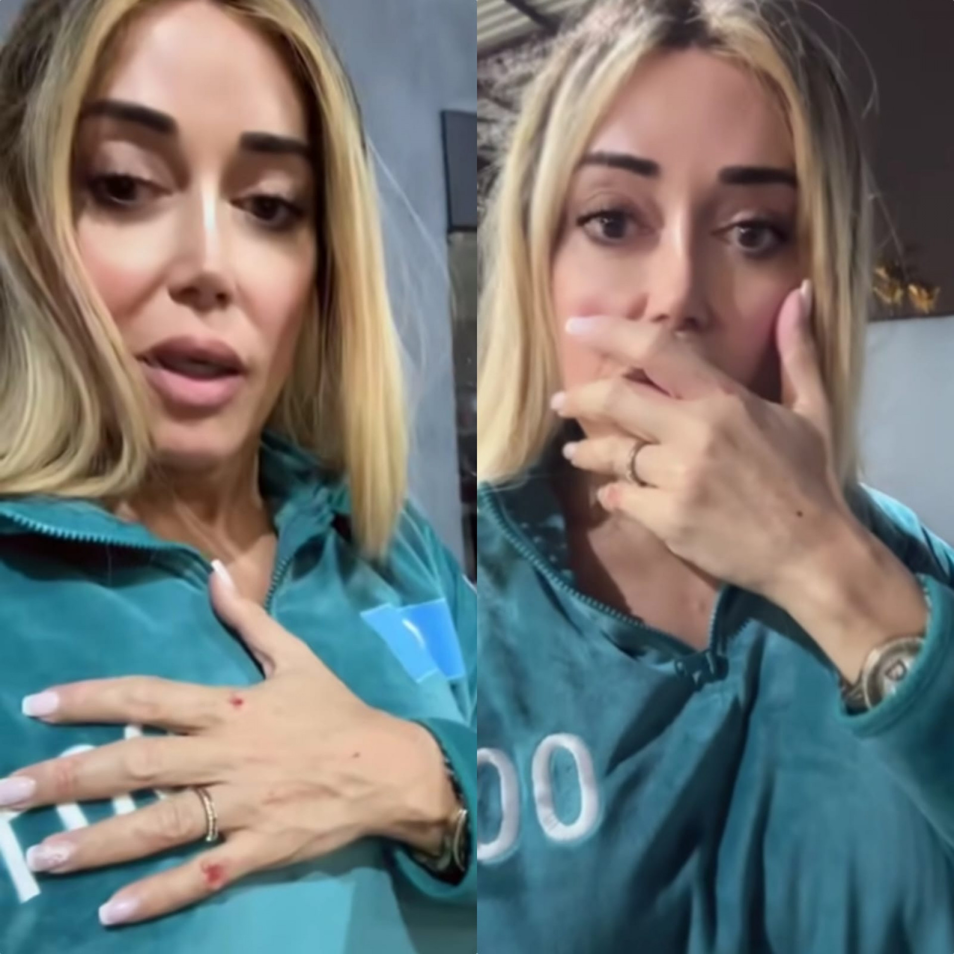 Mulher Abacaxi se machuca ao sofrer tentativa de assalto em São Paulo - Reprodução de vídeo / Instagram