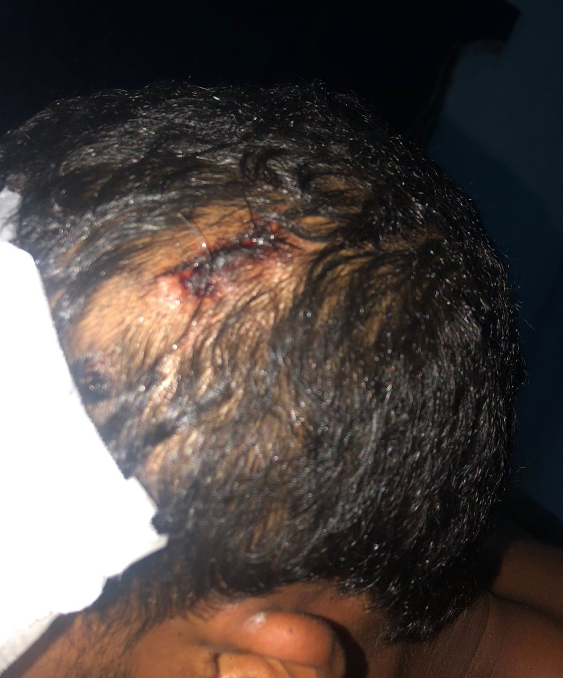 Marco precisou levar seis pontos na cabeça - Acervo pessoal