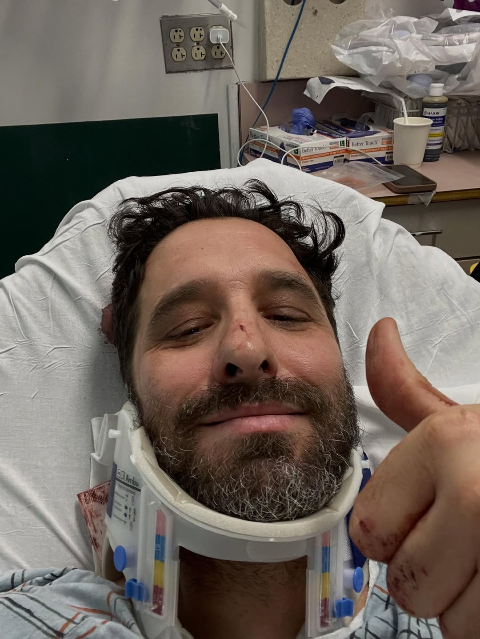 Rafinha Bastos sofre acidente em Nova Iorque: 'Apaguei no meio da rua' - Reprodução / Instagram