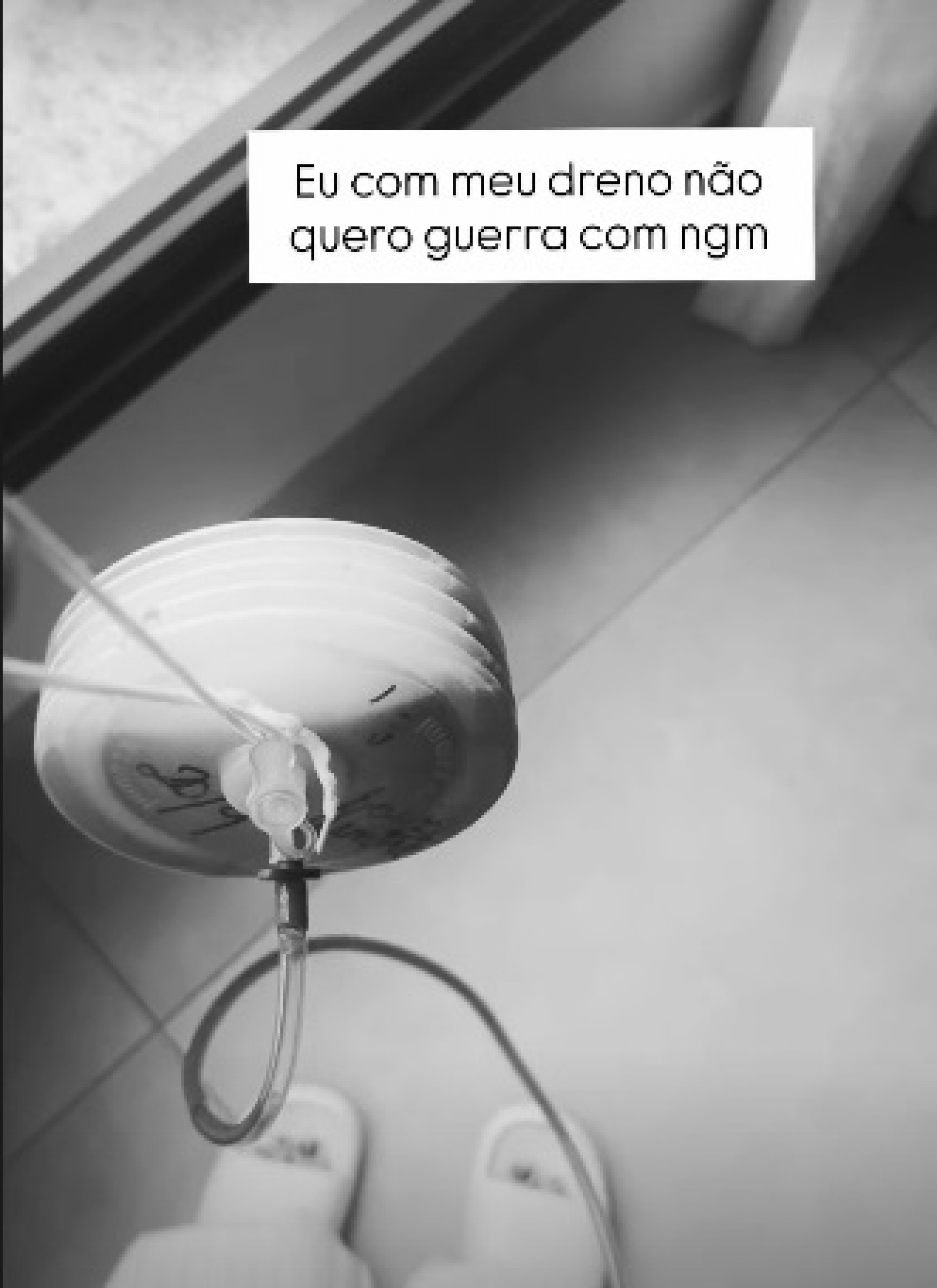 Amanda Meirelles exibiu dreno que está usando após o procedimento - Reprodução/Instagram