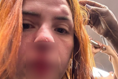 Mulher tem nariz quebrado ao levar socos no rosto dentro de vagão feminino do metrô