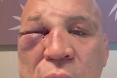 Vídeo! Wanderlei Silva se manifesta após confusão: 'Fui covardemente agredido'