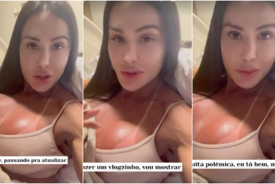 Gracyanne atualiza estado de saúde após cirurgia: 'Super inchada' 