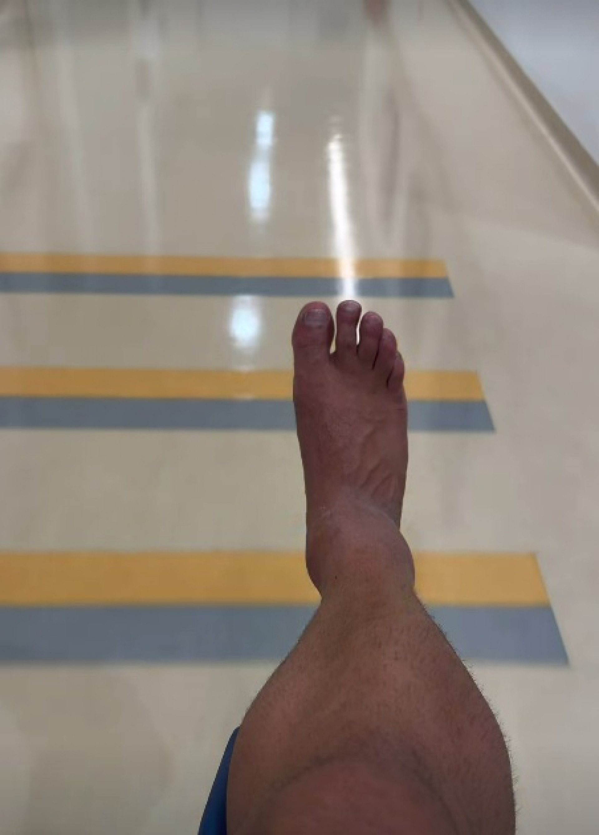 Kaká Diniz sofre lesão no tornozelo - Reprodução do Instagram