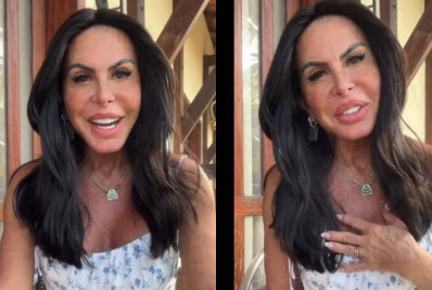 Gretchen surge com novo rosto após harmonização facial e ganha elogios: 'Está tão linda'