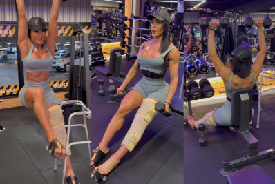 Com joelho imobilizado, Gracyanne Barbosa volta aos treinos depois de cirurgia