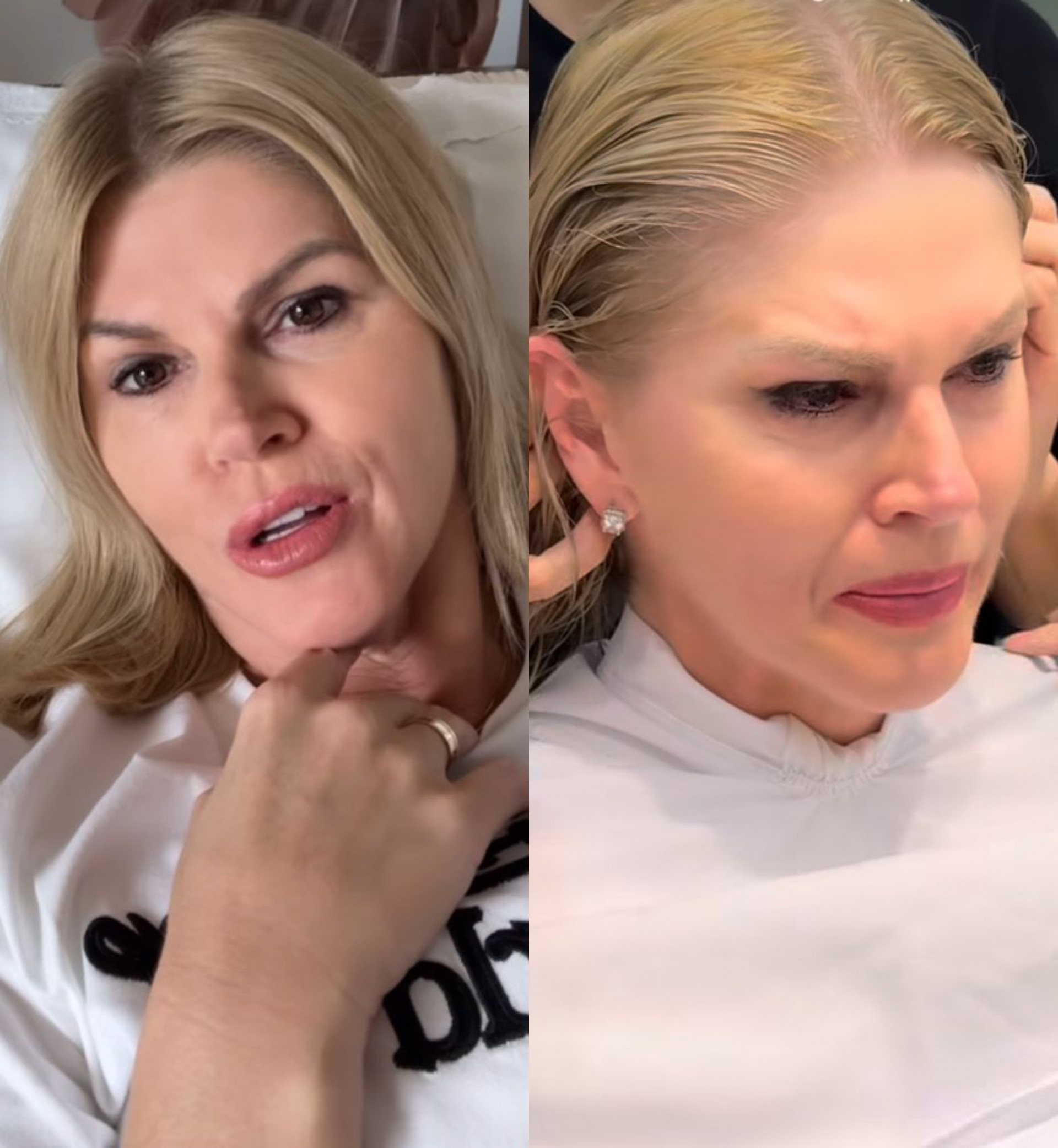 Val Marchiori se emociona e revela angústia antes do início do tratamento - Reproduçã0/Instagram