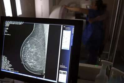 Falta de acesso a mamógrafos limita prevenção do câncer de mama