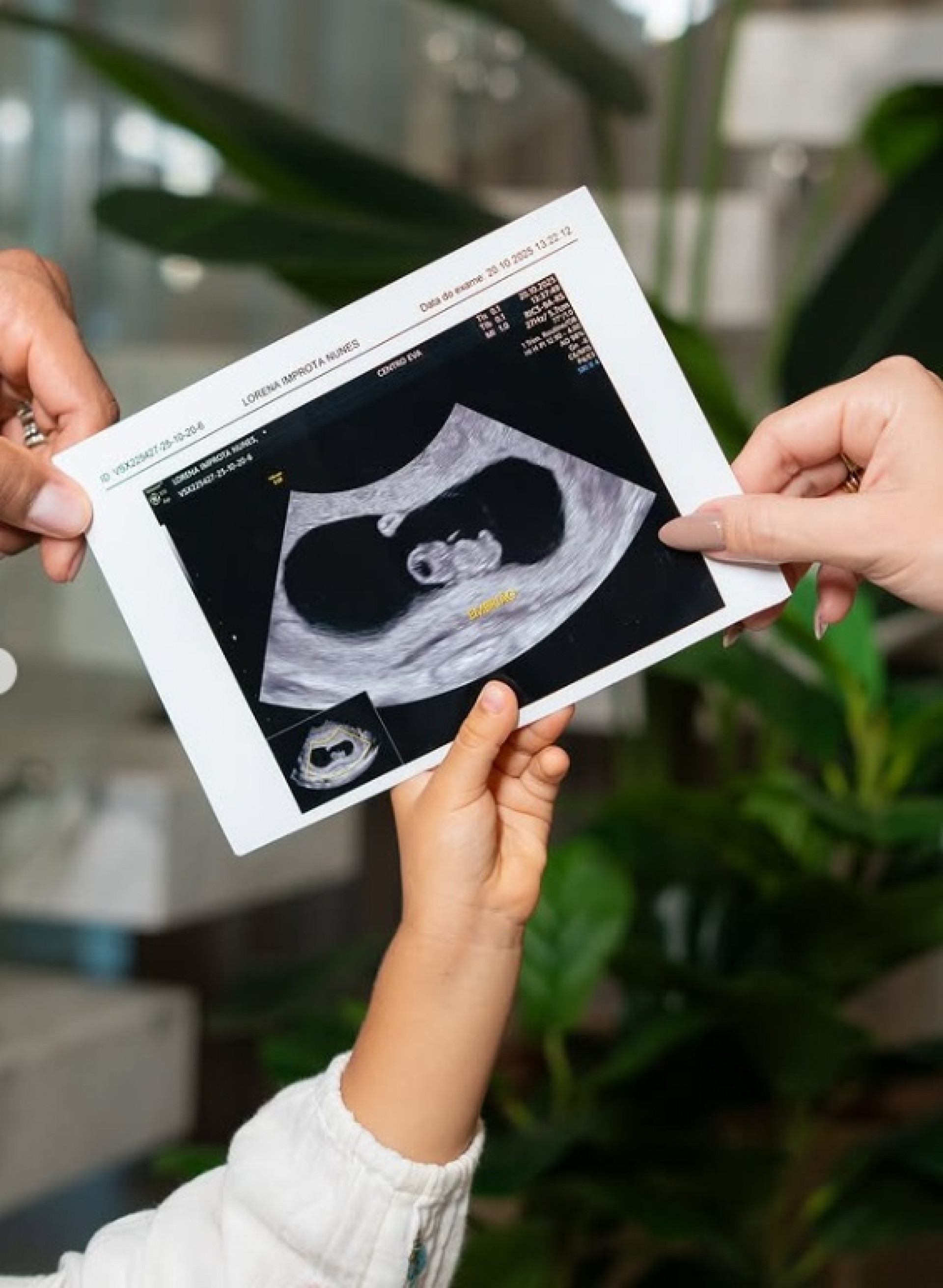 Imagem da ultrassonografia do segundo filho do casal - Reprodução/Instagram