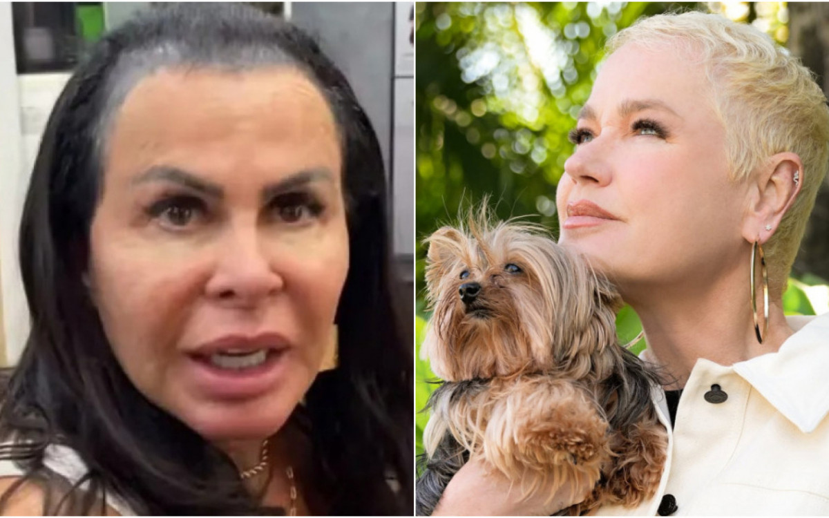 Gretchen e Xuxa tratam alopecia - Reprodução/Instagram