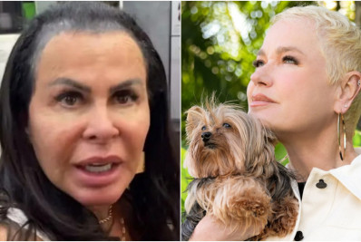 Entenda o que é alopecia feminina, que afeta famosas como Gretchen e Xuxa