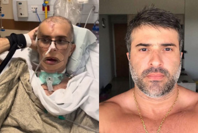 Vídeo: Piloto da Core baleado na cabeça emociona ao realizar novos movimentos no CTI