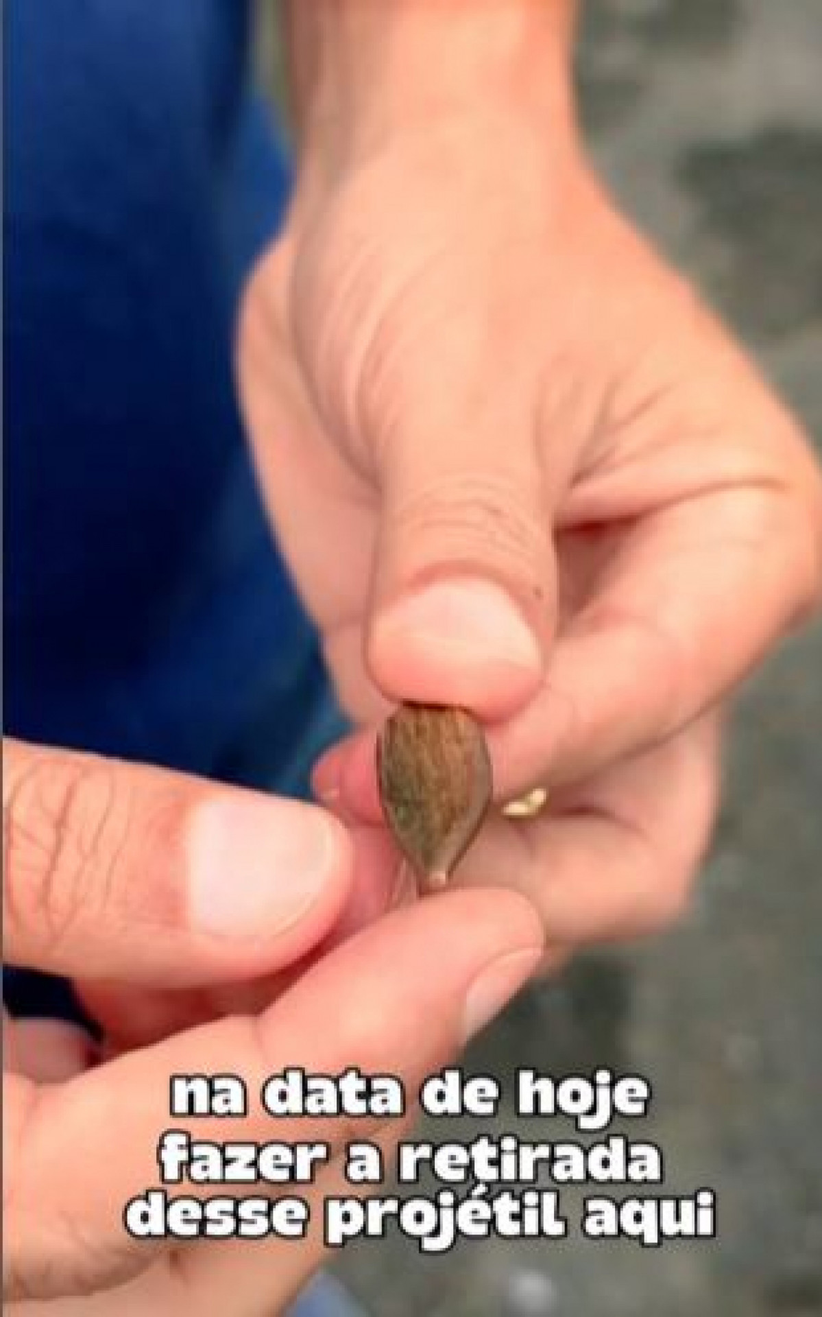 Proj&eacute;til retirado da lombar do animal - Reprodu&ccedil;&atilde;o