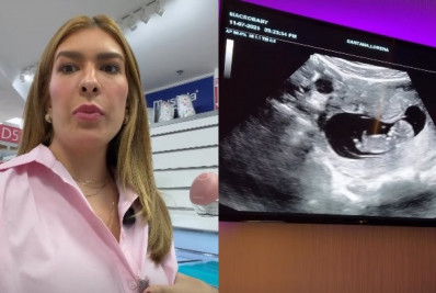 Grávida, Lore Improta compartilha ultrassom do segundo filho