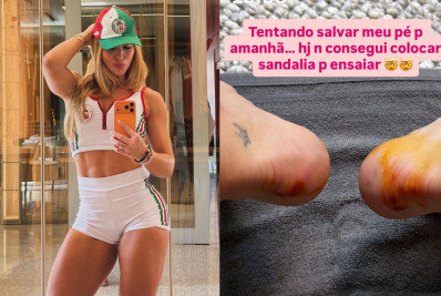 Virginia exibe machucados nos pés na véspera de ensaio na Grande Rio