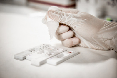 Mutirão de testagem em Macaé oferece exames gratuitos para ISTs no feriado