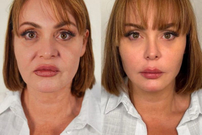 Gaby Spanic faz harmonização facial e transformação impressiona os fãs