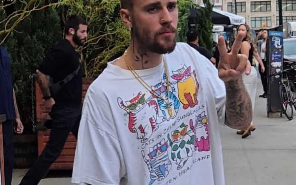 Justin Bieber sofreu queda de um skate elétrico