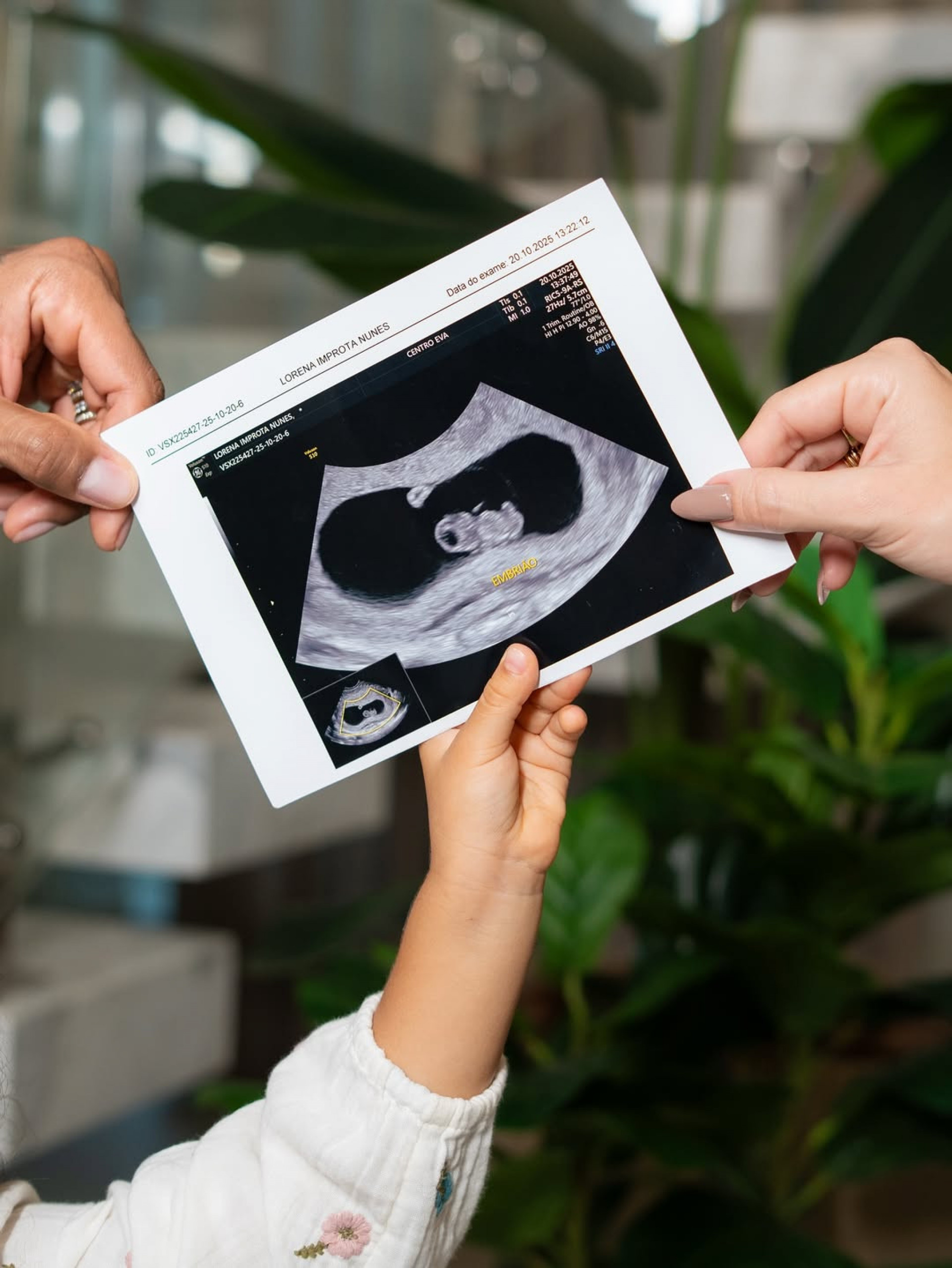 Lore Improta compartilhou ultrassom para anunciar nova gestação  - Reprodução/Instagram 