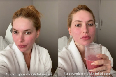 Virginia Fonseca faz procedimento para remoção de cicatriz  