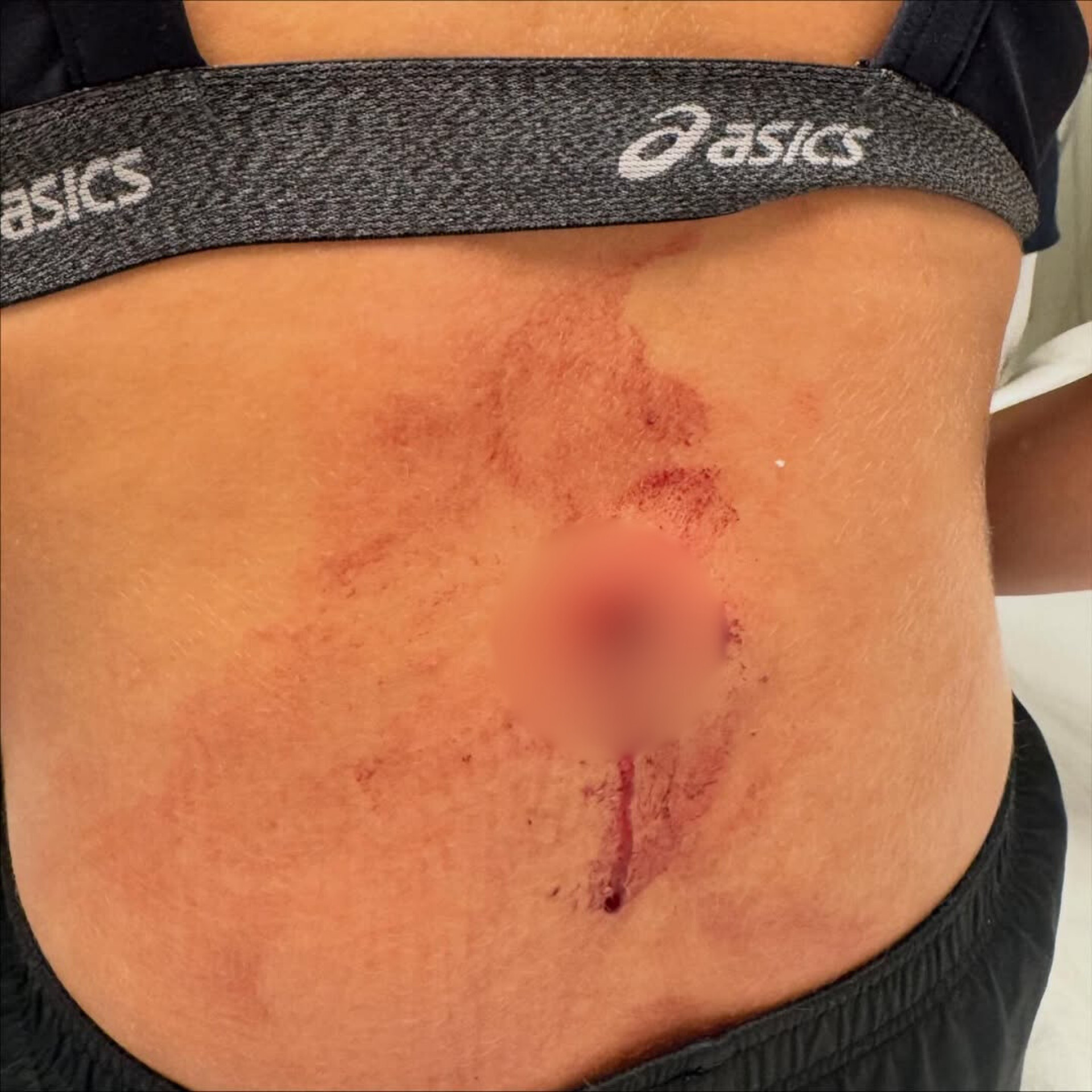 Atleta de vôlei foi baleada nas costas enquanto voltava para casa, na Tijuca - Reprodução / Instagram