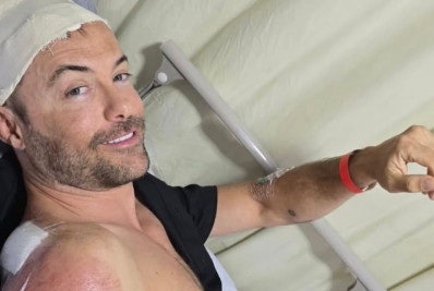 Kayky Brito sofre acidente de bicicleta e leva pontos na cabeça