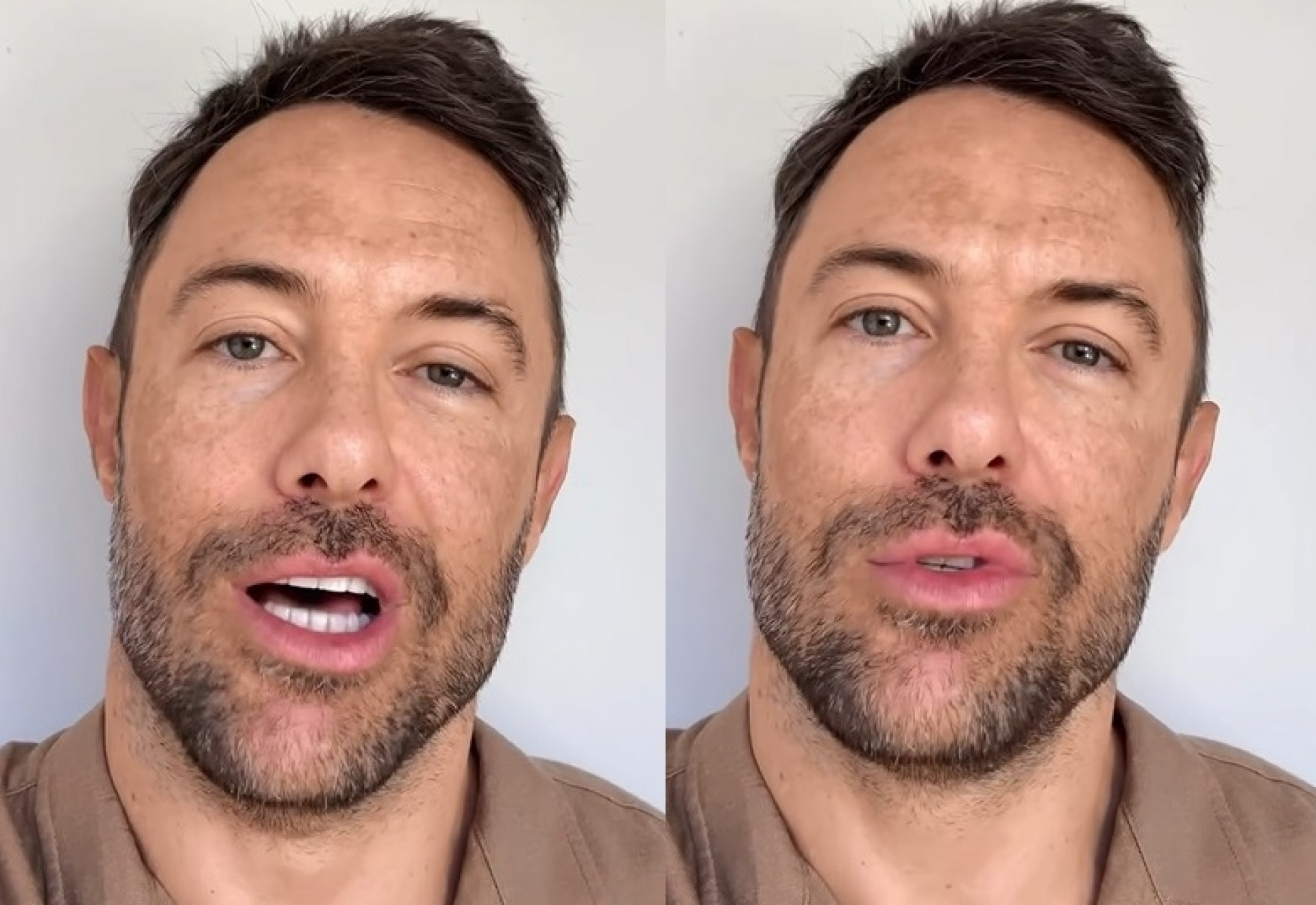 Kayky Brito revelou que não usava capacete quando caiu de bicicleta  - Reprodução/Instagram 