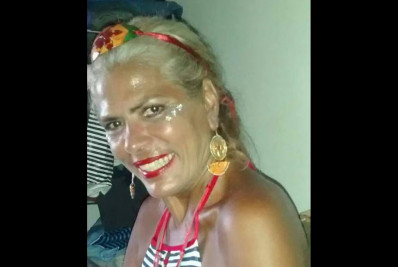 Ex-chacrete morre após ser atacada por pitbull 