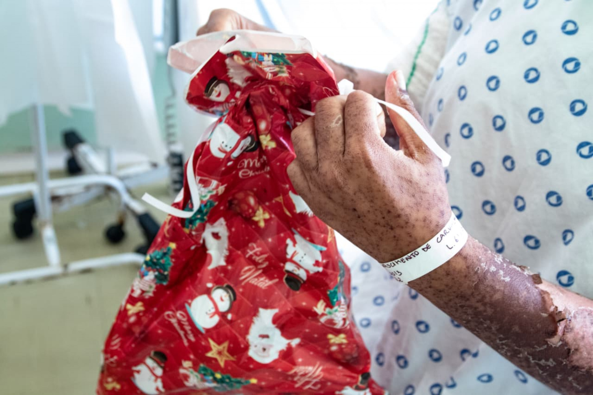 Pacientes do centro de tratamento de queimados receberam carinho e presentes  - &Eacute;rica Martin / Ag&ecirc;ncia O Dia
