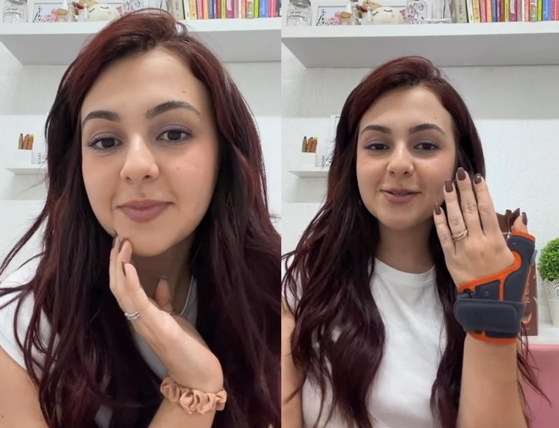 Klara Castanho detalhou situação em que sofreu luxação no dedo - Reprodução/Instagram