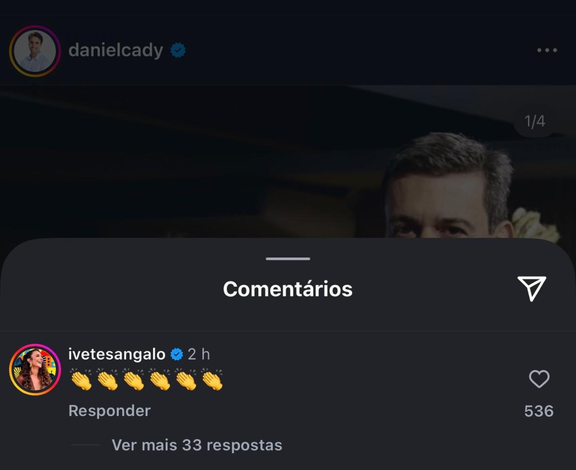 Após término do casamento, Ivete Sangalo comenta publicação do ex-marido - Reprodução / Instagram