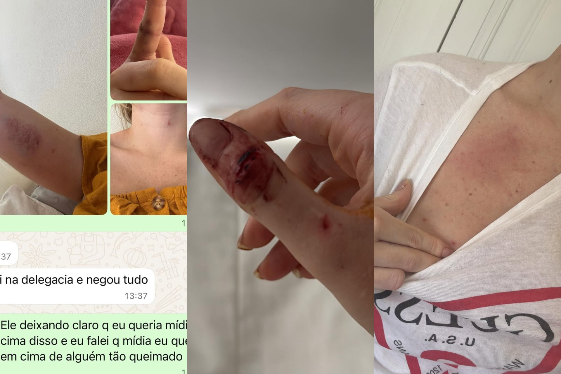 Ex de Dado Dolabella, Marcela Tomaszewski posta fotos e prints de agressões - Reprodução / Instagram