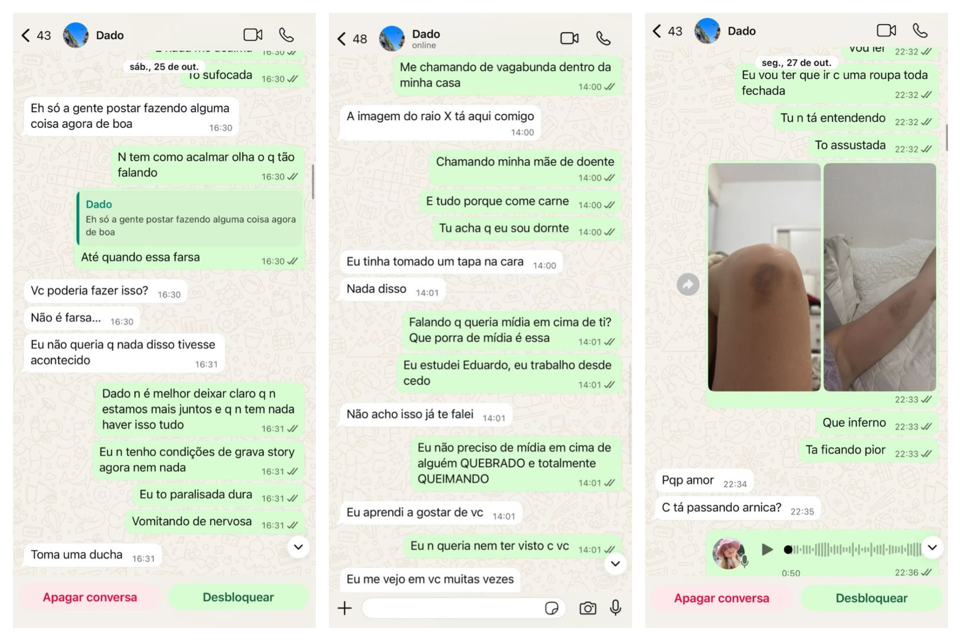 Ex de Dado Dolabella, Marcela Tomaszewski posta fotos e prints de agressões - Reprodução / Instagram