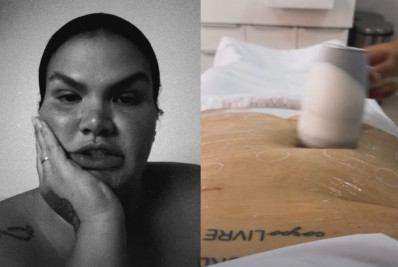 Thais Carla rebate comentários sobre tratamento de pele