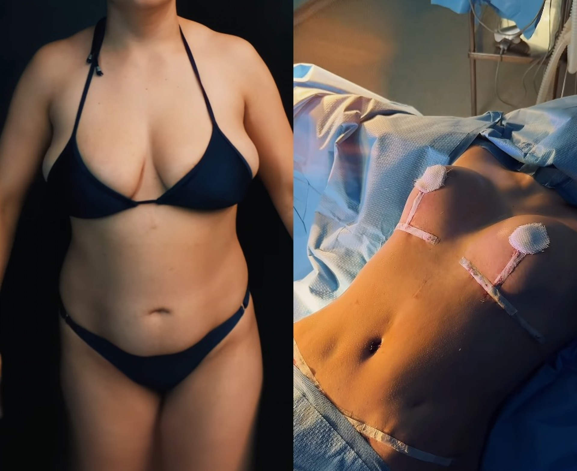 Antes e depois do corpo de Camila Moura - Reprodução / Instagram