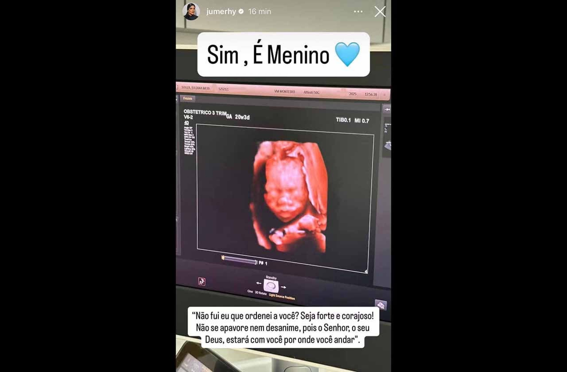 Influenciadora grávida de Gil revela sexo do bebê; namorada do ex-jogador arquiva fotos