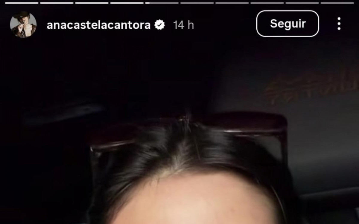 Ana Castela surge com olho inchado