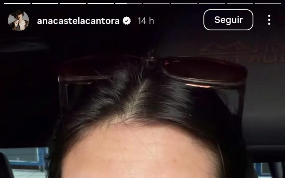 Ana Castela mostra olho inchado