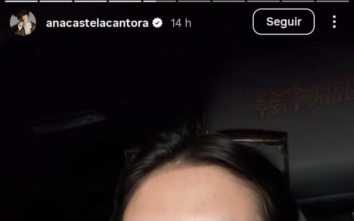 Ana Castela aparece com olho inchado