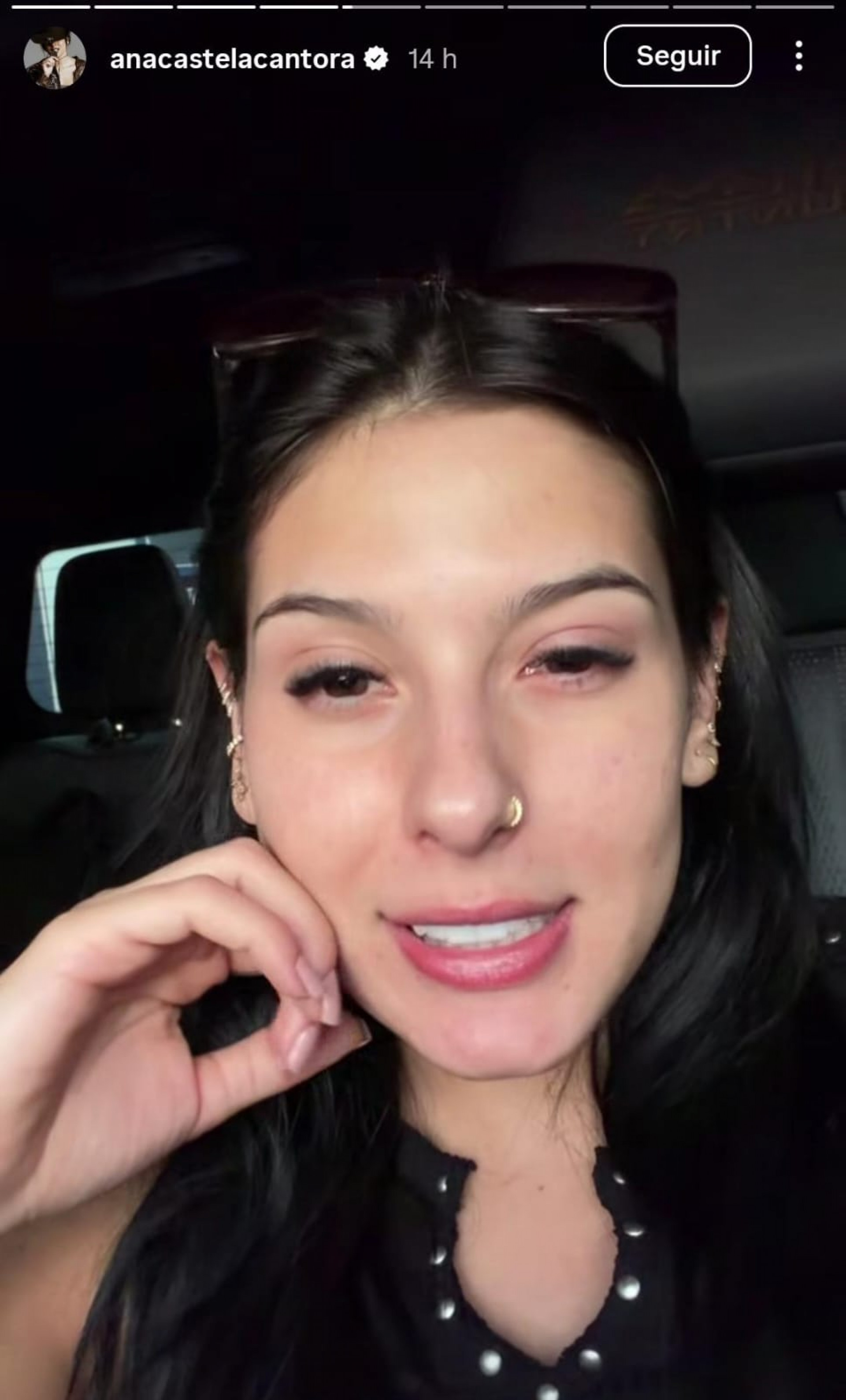 Ana Castela surge com olho inchado - Reprodução de vídeo / Instagram