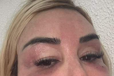 Patrícia Ribeiro passa por nova cirurgia no rosto e caso lembra Juju do Pix