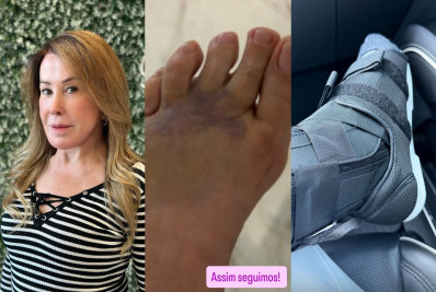 Zilu Camargo relata queda em casa e fratura no pé