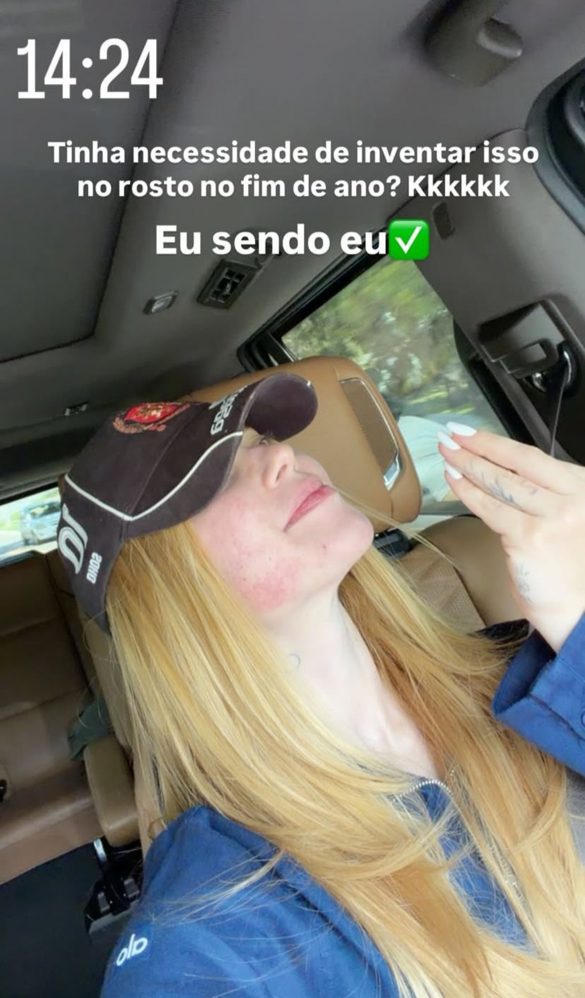 Virginia mostra resultado de procedimento - Reprodução/Instagram