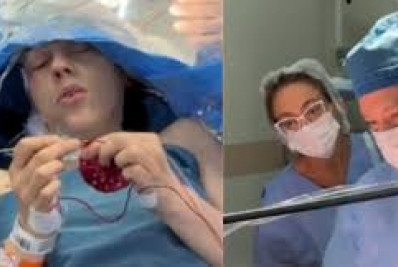 Mulher faz tricô enquanto passa por cirurgia no cérebro