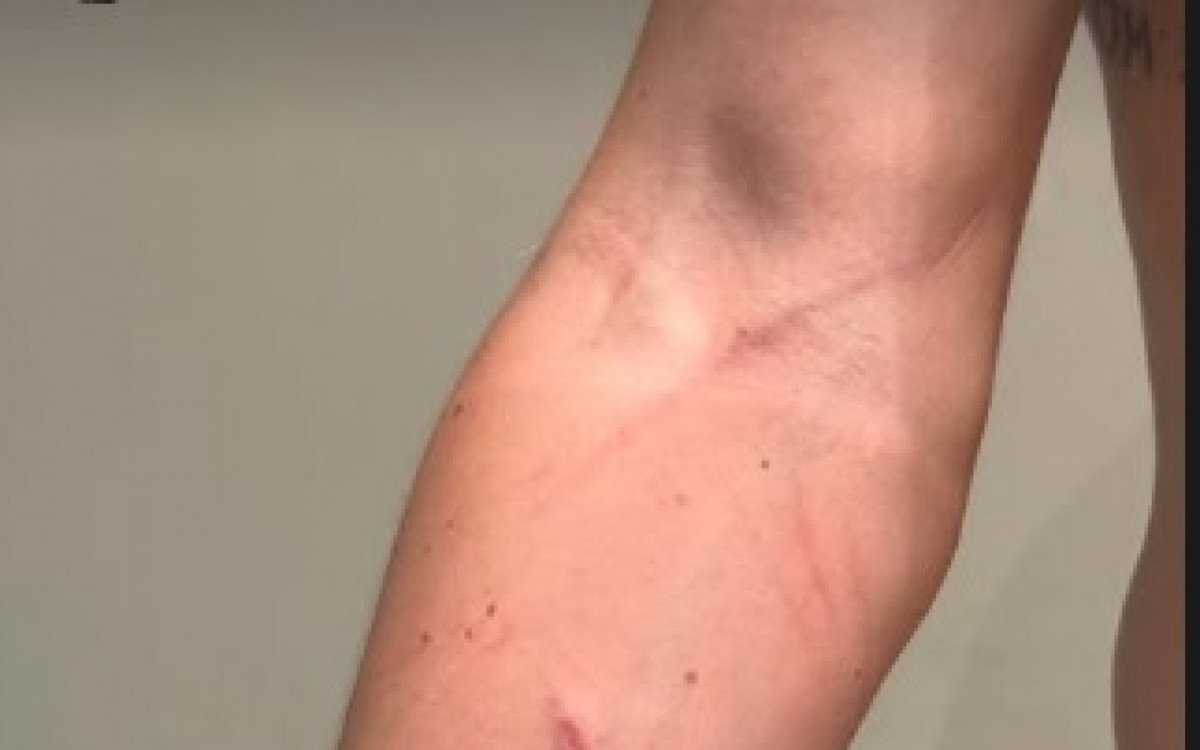 Danilo Bravo mostra arranh&otilde;es